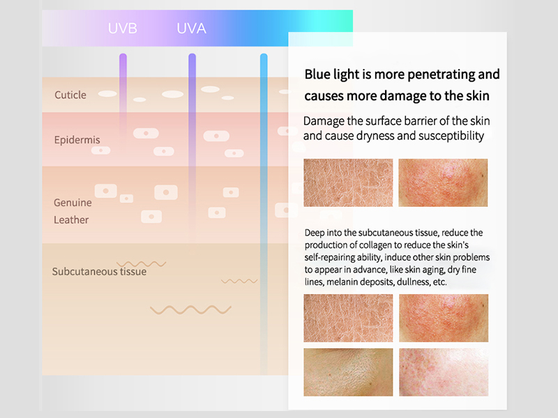 Anti-Blue Toner Spray 5