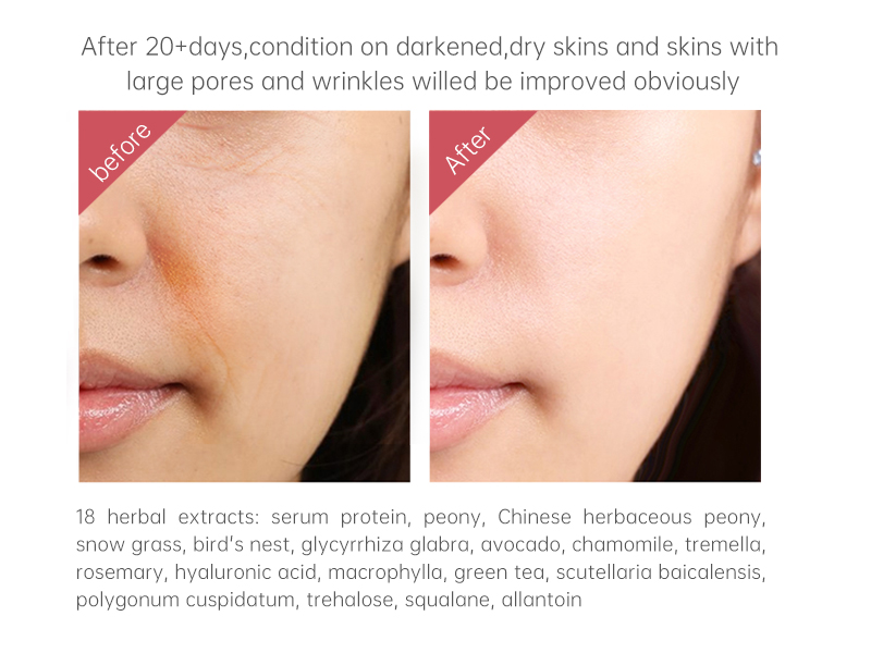 Serum Albumin Skin Care Set 3